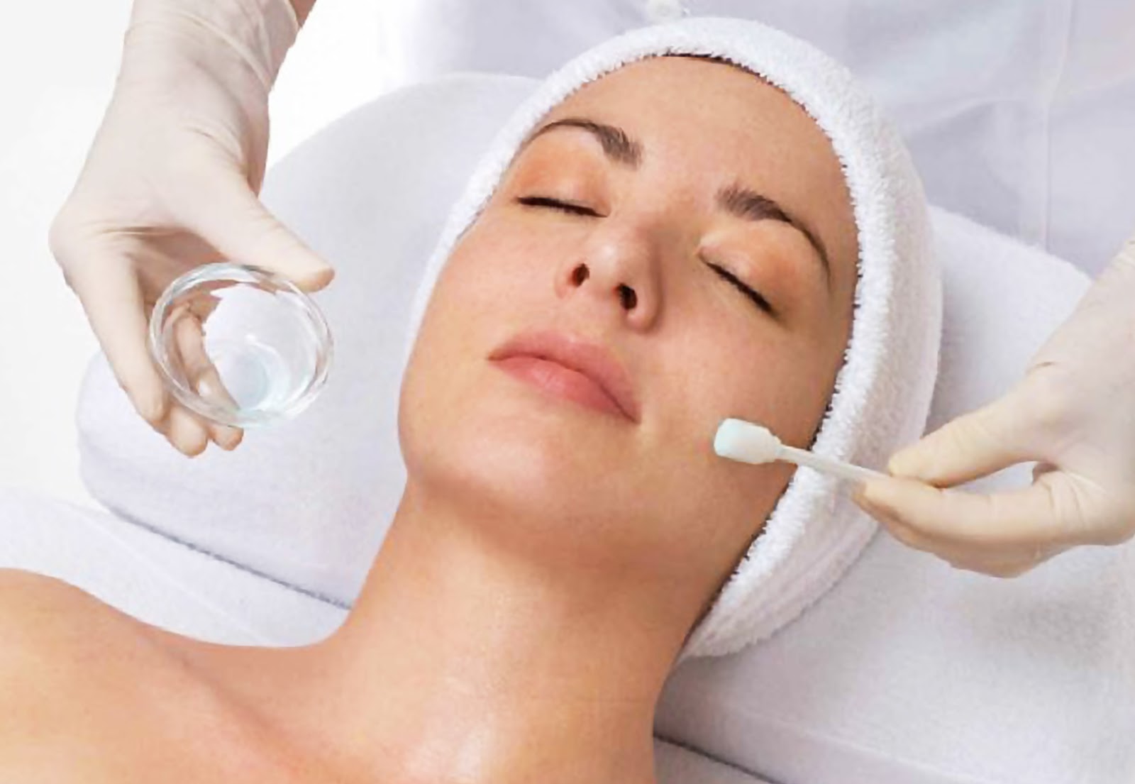 Peeling chimico - medicina estetica viso 