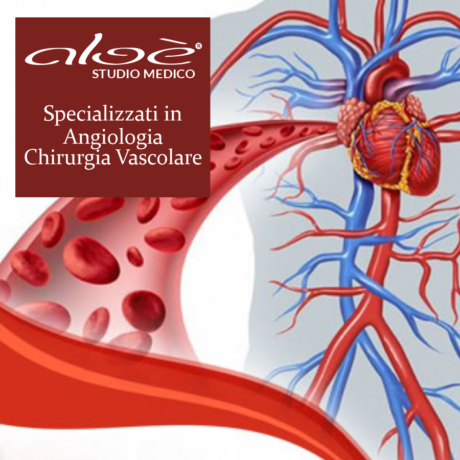 CHIRURGIA VASCOLARE